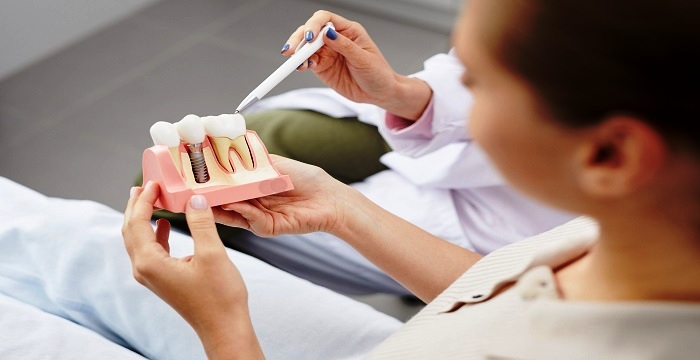 5 Ways You Can Finance Your Dental Implant Treatment